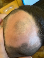 ROST PREMIUM 10% Средство для роста бороды волос и усов / Сыворотка против облысения у мужчин / Лосьон от выпадения волос #6, вероника л.