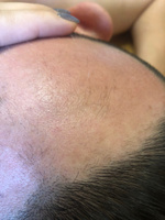 ROST PREMIUM 10% Средство для роста бороды волос и усов / Сыворотка против облысения у мужчин / Лосьон от выпадения волос #3, вероника л.